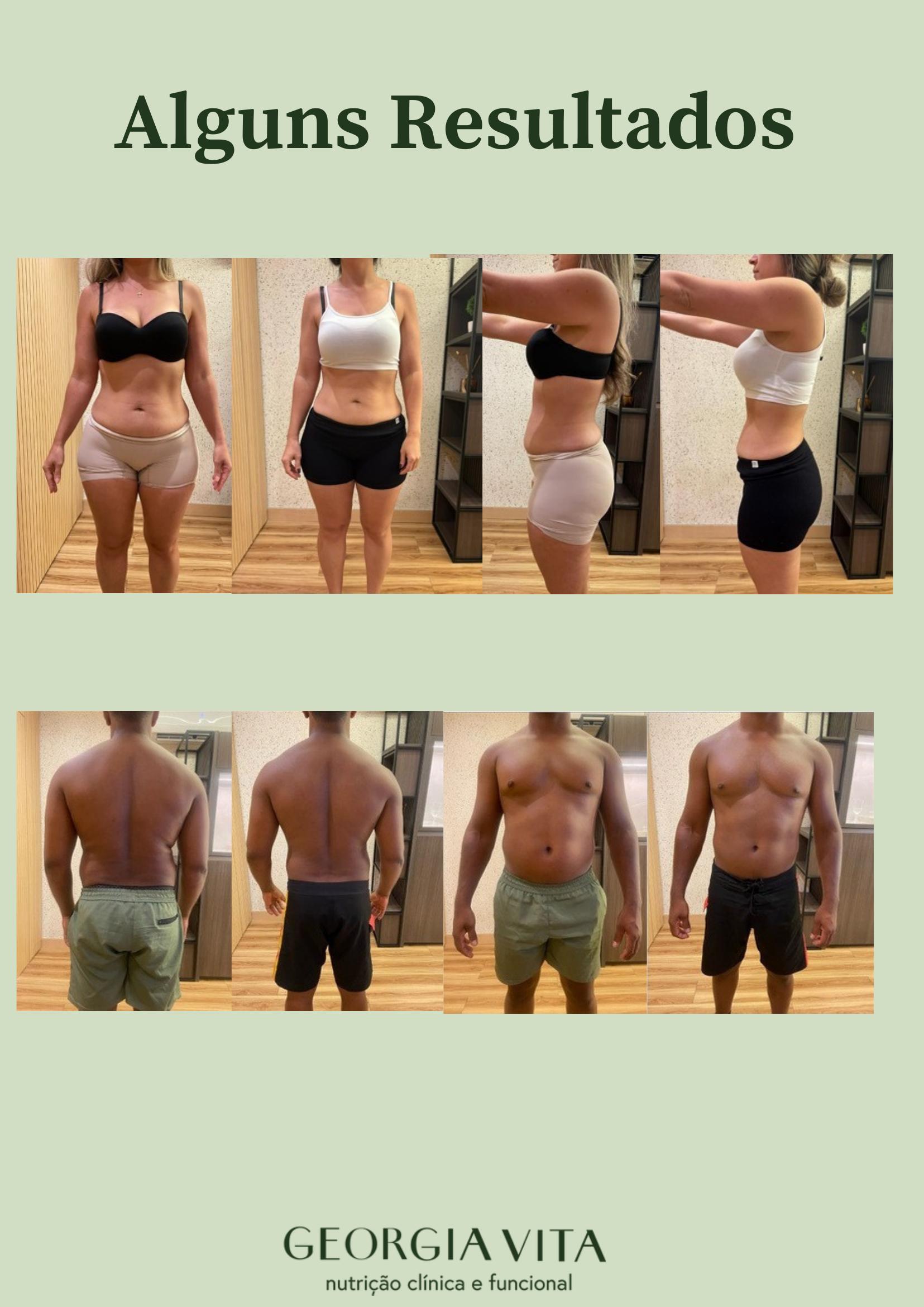 Antes e depois de pacientes acompanhados pela nutricionista Georgia Vita