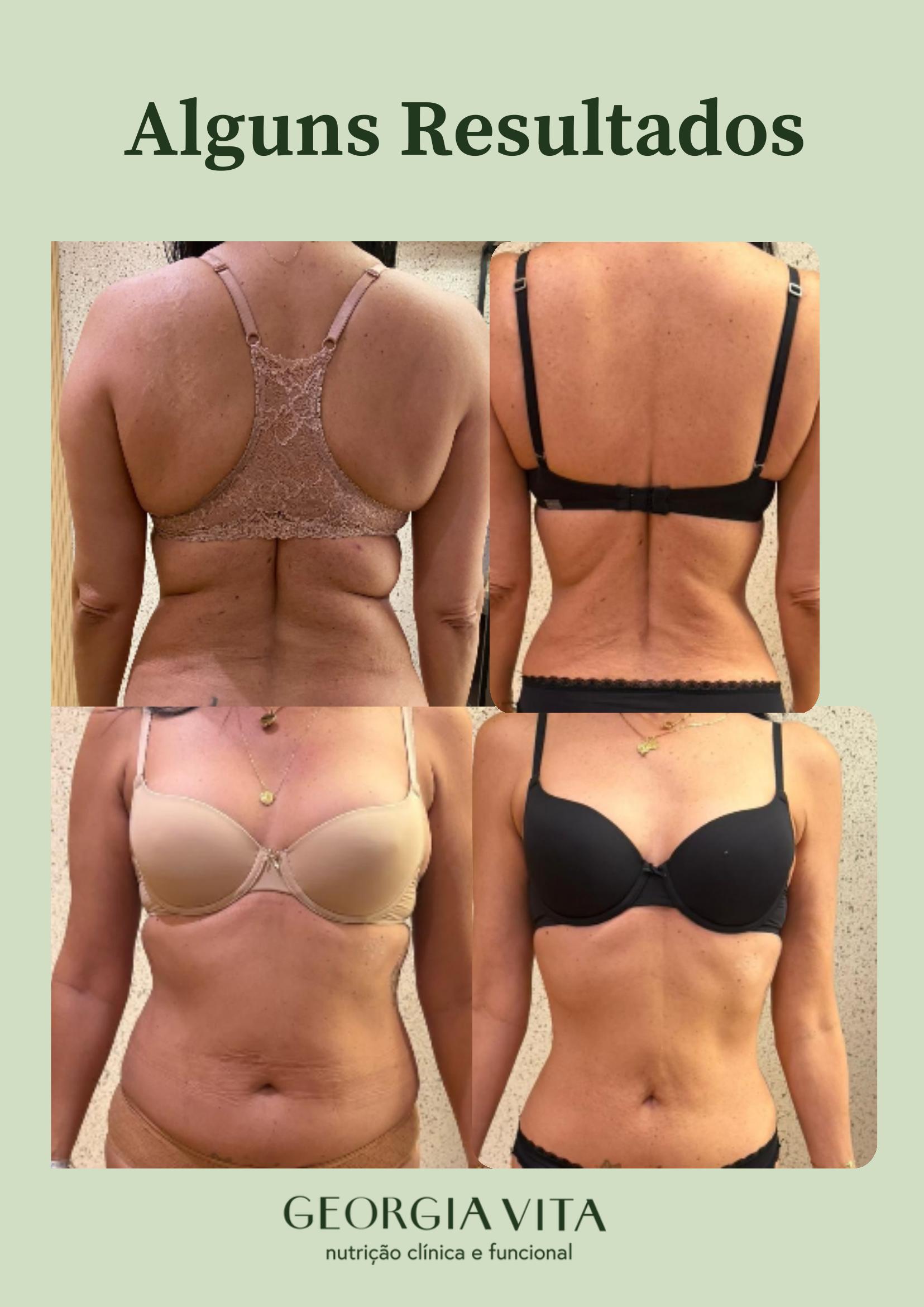 Resultados de antes e depois de pacientes em acompanhamento nutricional